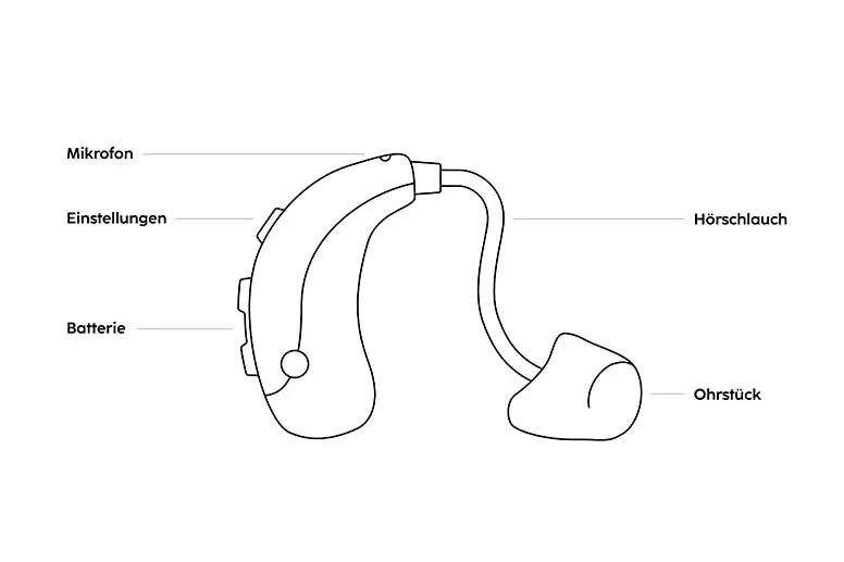 Illustration zum Aufbau von Hörgeräten.